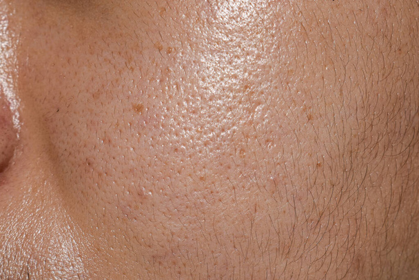 Une peau claire aux pores larges face à un jeune homme adulte sud-est asiatique, birman ou coréen. - Photo, image