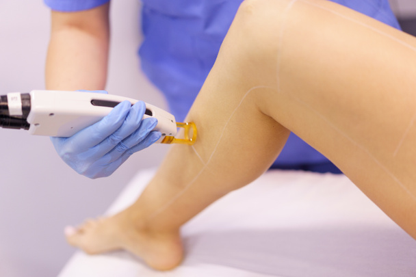 Woman receiving legs laser hair removal at a beauty center. - Fotoğraf, Görsel