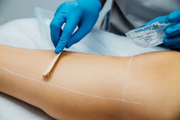 Application of contact transparent gel before the laser hair removal procedure. Application of sugar paste for the sugaring procedure. Skin care, cosmetic procedures. Women's legs. Beauty salon. - Foto, Imagen