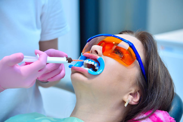 Woman dentist applies whitening gel to patient's teeth. Teeth whitening in a dental clinic concept. Close up - Fotoğraf, Görsel