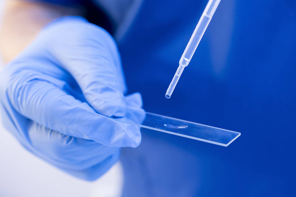 Zárja be a kutató segítségével eldobható pipetta betölteni biológiai mintákat egy pohár. DNS teszt, családi kötelék koncepció - Fotó, kép