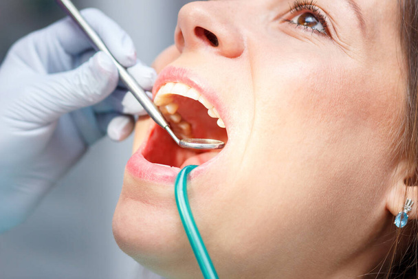 Examination oral cavity or treatment teeth, visiting dental office, soft focus background - Foto, imagen