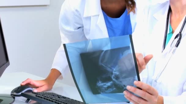 female doctors analysing x-ray film - Materiał filmowy, wideo