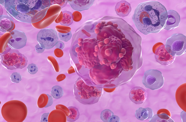 Ostra białaczka limfoblastyczna (ALL) komórki nowotworowe w przepływie krwi - widok z bliska 3d ilustracja - Zdjęcie, obraz