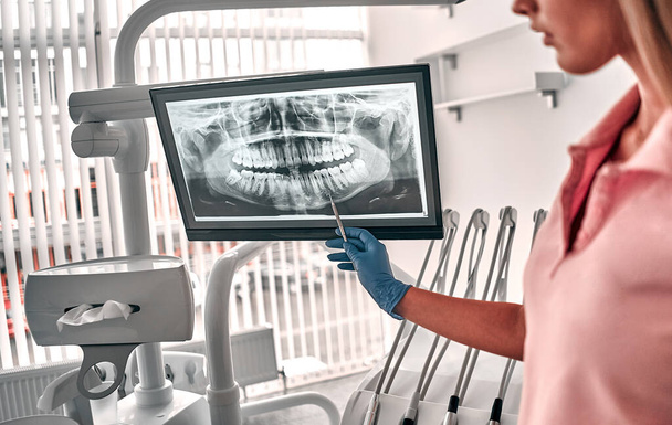 Beeld van arts of tandarts presenteren met tand x-ray film aan te bevelen patiënt in de behandeling van tandheelkunde en tandheelkunde, werken op de werkplek. - Foto, afbeelding