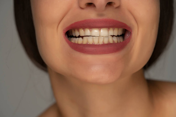 Макро крупним планом жіноча посмішка показує здорові білі зуби
 - Фото, зображення