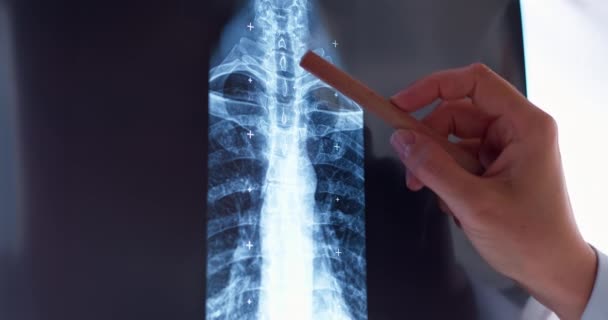 médico exemine huesos en rayos X - Imágenes, Vídeo