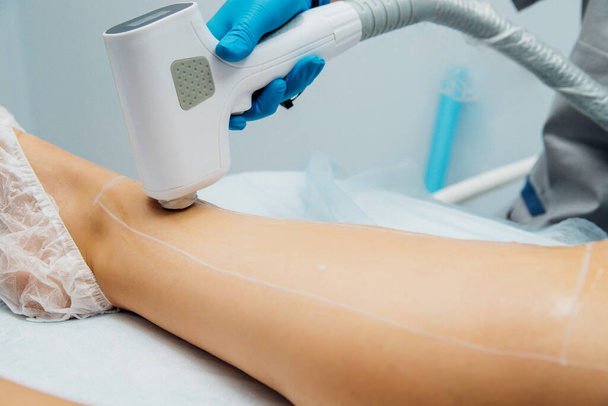 Application of contact transparent gel before the laser hair removal procedure. Application of sugar paste for the sugaring procedure. Skin care, cosmetic procedures. Women's legs. Beauty salon. - Foto, Imagem