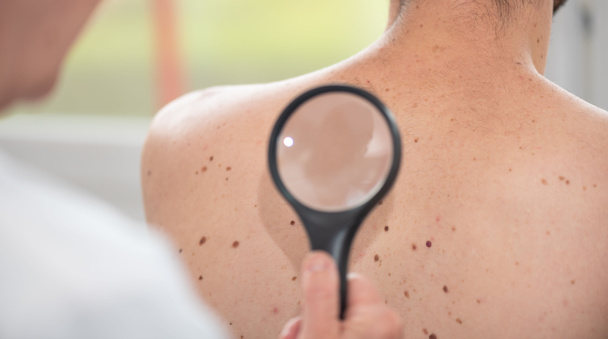Dermatologe untersucht die Haut des Patienten Rücken - Foto, Bild