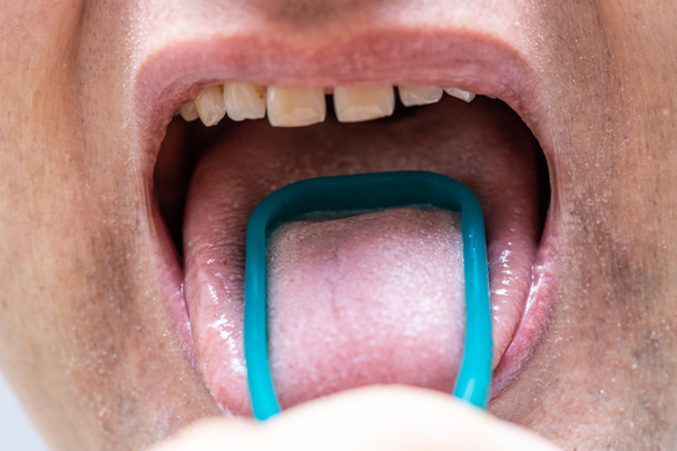 Στοματική υγιεινή, Ο άνθρωπος καθαρίζει τη γλώσσα του αφαιρώντας την επικάλυψη με μια σπάτουλα  - Φωτογραφία, εικόνα