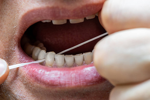 Higiena jamy ustnej, czyszczenie zębów nitką dentystyczną  - Zdjęcie, obraz