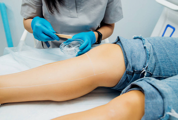 Application of contact transparent gel before the laser hair removal procedure. Application of sugarpaste for the sugaring procedure. Skin care, cosmetic procedures. Women's legs. Beauty salon. - Foto, Imagem