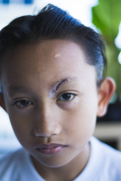 外科用接着剤のステッチの後の小さい切り傷を癒した。東南アジア、二重まぶたのマレーシアの小さな男の子の左眉で怖い。健康コンセプト. - 写真・画像