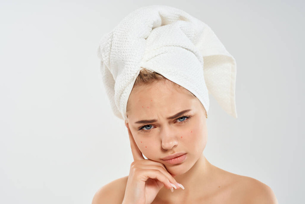 mujer bonita hombros desnudos tratamiento del acné dermatología - Foto, imagen