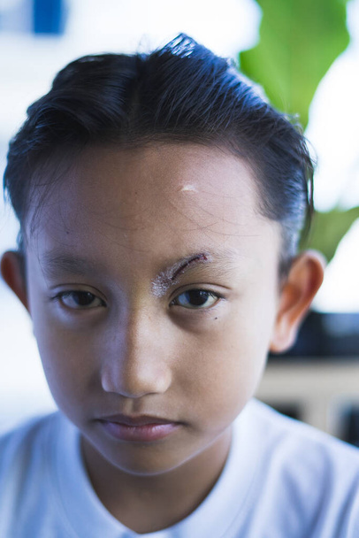 外科用接着剤のステッチの後の小さい切り傷を癒した。東南アジア、二重まぶたのマレーシアの小さな男の子の左眉で怖い。健康コンセプト. - 写真・画像