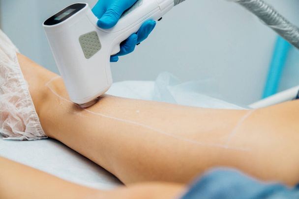 The procedure of laser hair removal of women's legs. Application of sugar paste for the sugaring procedure. Skin care, cosmetic procedures. - Φωτογραφία, εικόνα