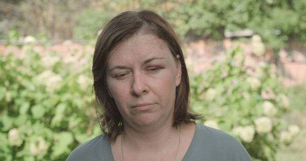 У расстроенной женщины фингал под глазом. Концепция домашнего насилия - Фото, изображение