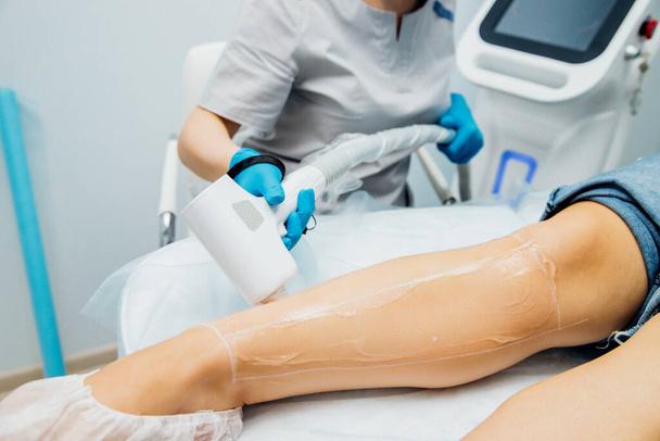 The procedure of laser hair removal of women's legs. Application of sugar paste for the sugaring procedure. Skin care, cosmetic procedures. - Fotoğraf, Görsel