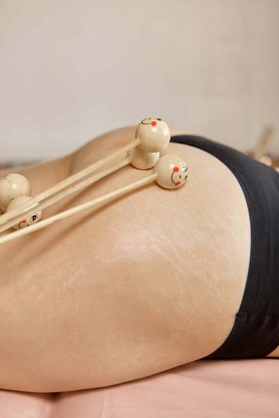 Vrouwelijke masseur doet anti cellulitis massage op vrouwelijke dij. Maderotherapie behandeling. Spa behandelingen, gezondheid, schoonheid, dieet. Close-up van de dijen van de cliënt en de handen van de masseur - Foto, afbeelding