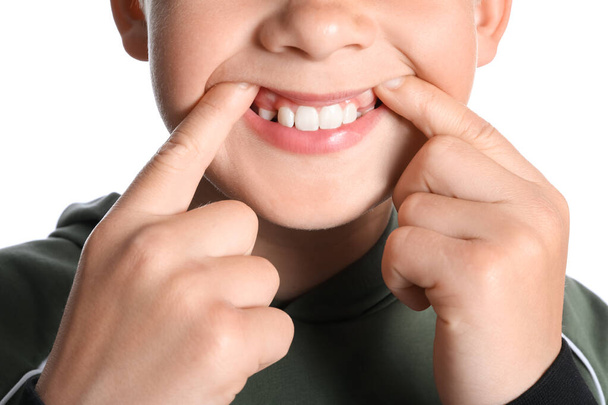 Little boy with healthy gums on white background, closeup - Φωτογραφία, εικόνα