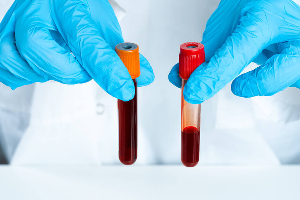 Doctors hands in blue gloves keep test tube with a blood - Фото, зображення