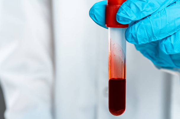 Doctors hands in blue gloves keep test tube with a blood - Fotó, kép