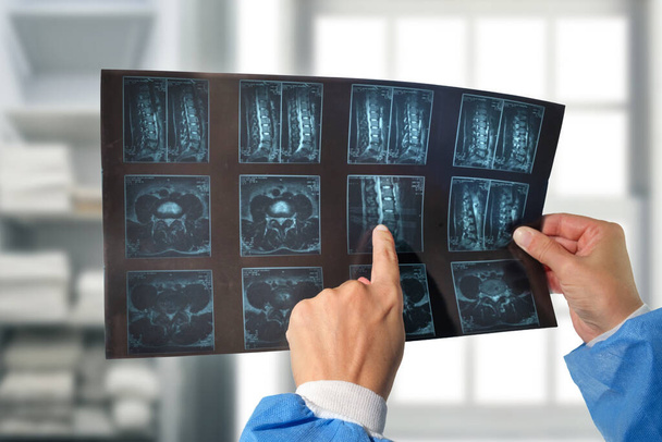 Руки лікаря, що тримають і аналізують рентгенографію хребта
  - Фото, зображення