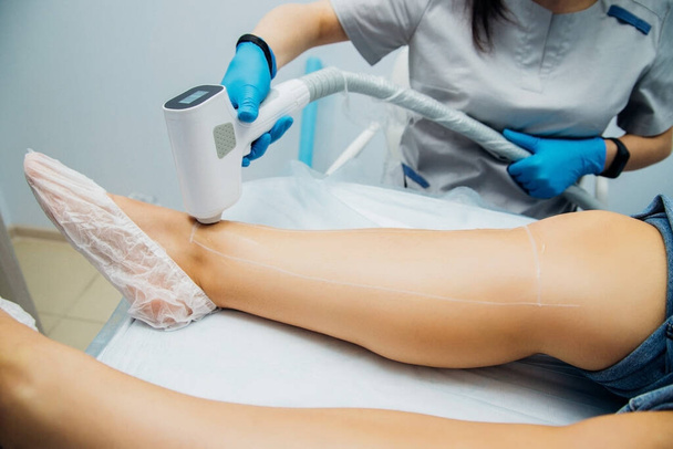 Application of contact transparent gel before the laser hair removal procedure. Application of sugar paste for the sugaring procedure. Skin care, cosmetic procedures. Women's legs. Beauty salon. - Foto, Bild