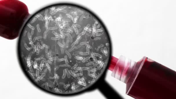 Αναζήτηση βακτηρίων στο αίμα - Πλάνα, βίντεο