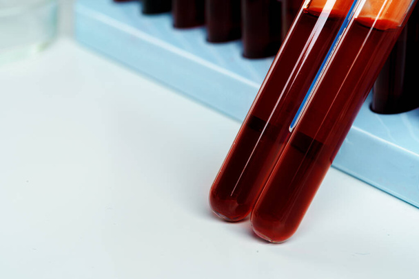 Blood sample tubes medical equipment close up - Fotoğraf, Görsel