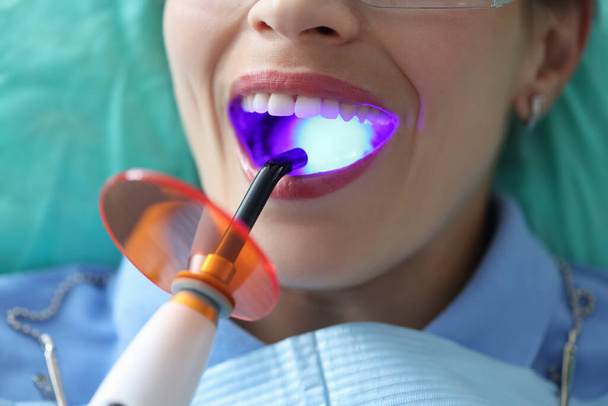 Mulher na consulta com o dentista, boca de perto - Foto, Imagem