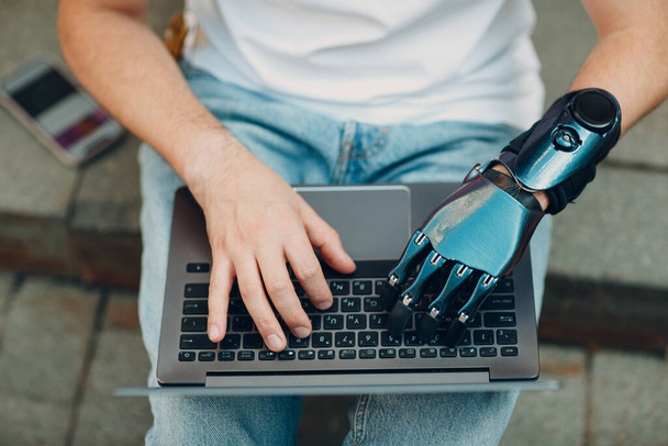 Młody niepełnosprawny mężczyzna ze sztuczną protezą dłoni za pomocą pisania na klawiaturze komputera laptopa. - Zdjęcie, obraz