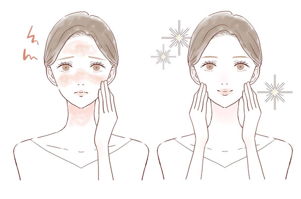 Avant et après des femmes souffrant d'inflammation de la peau. Sur fond blanc. - Vecteur, image