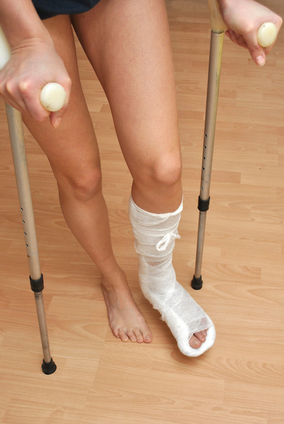 Σπασμένο πόδι - Φωτογραφία, εικόνα