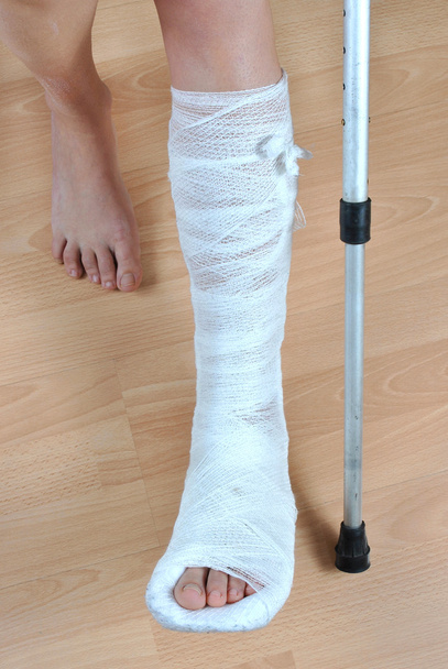 зламаною ногою
 - Фото, зображення