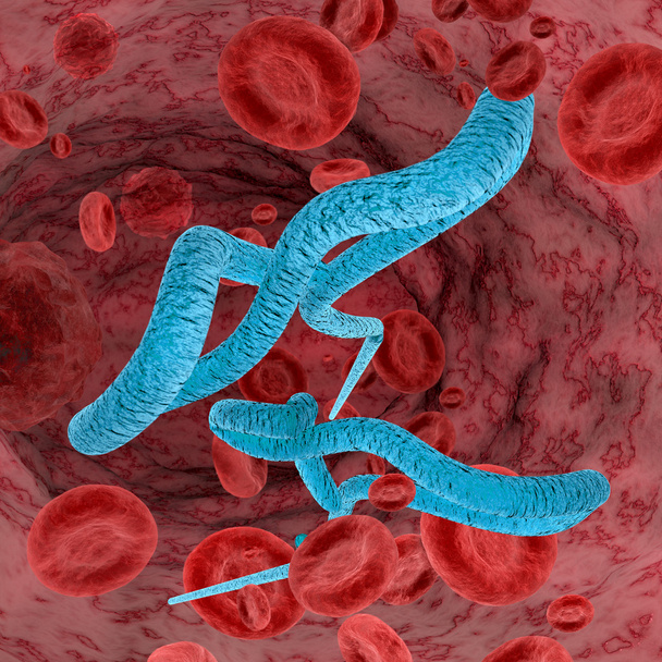 Ebola-Virus - Foto, Bild