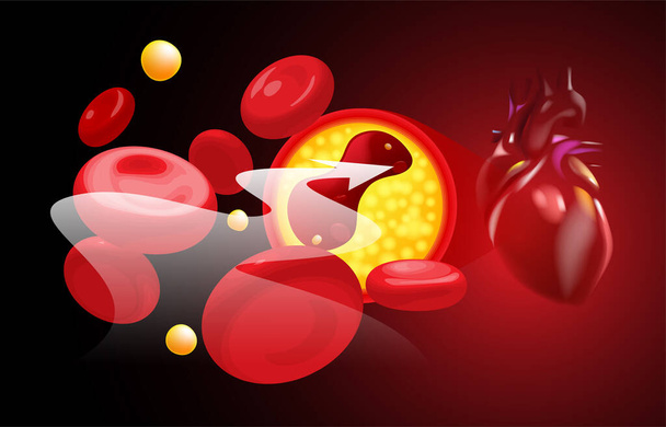 globuli rossi e colesterolo intasamento prima del cuore. - Vettoriali, immagini