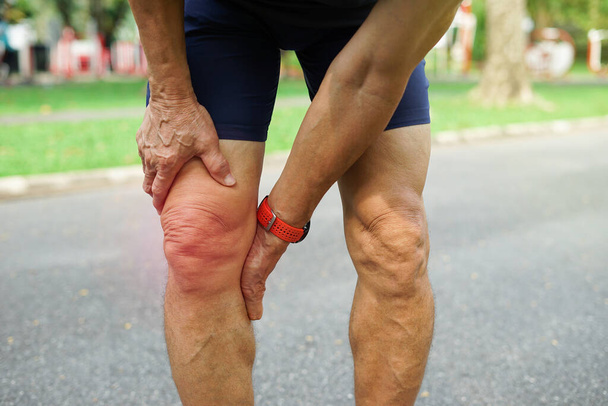 een oude man ondersteunt zijn knie tijdens het sporten in het park, concept kniepijn van lichaamsbeweging bij oudere mensen.                    - Foto, afbeelding