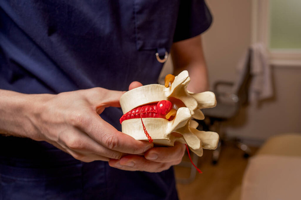 Der osteopathische Arzt hält ein Modell der Wirbelsäule mit Leistenbruch in der Hand. Medizin. Hochwertiges Foto - Foto, Bild