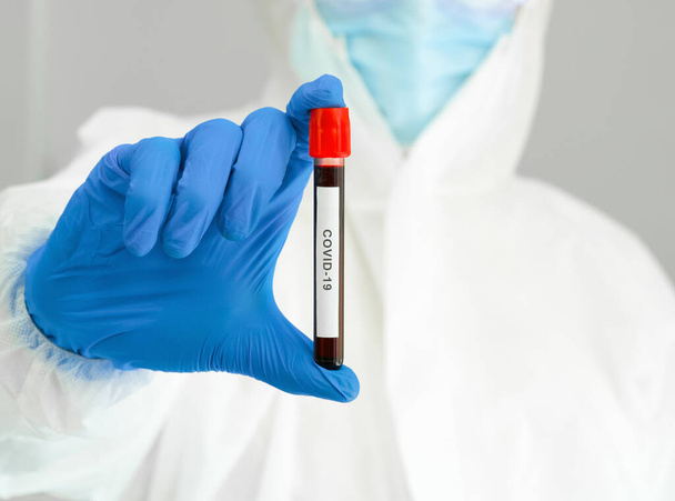 Araştırmacının elinde Covid-19 ile enfekte olmuş bir hastanın kan örneği. Coronavirus hastalığı 2019 Bir laboratuarda test süreci. - Fotoğraf, Görsel