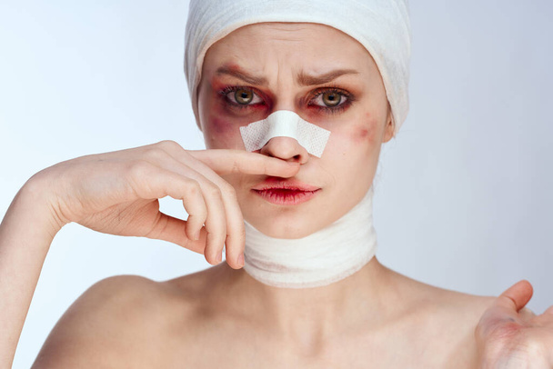 female patient plastic surgery operation bare shoulders studio lifestyle - Φωτογραφία, εικόνα
