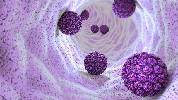 Infectie van het humaan papillomavirus. Virus. HPV is de meest voorkomende seksueel overdraagbare infectie wereldwijd. HPV-infectie wordt veroorzaakt door het humaan papillomavirus, een Dna-virus uit de familie van papillomavirus, 3D-rendering - Foto, afbeelding