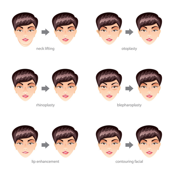 Plastic surgery on face vector set - Vector, Image