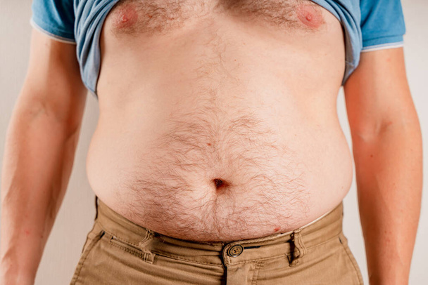 Hombre obeso con sobrepeso mostrando su gran vientre desnudo - Foto, Imagen