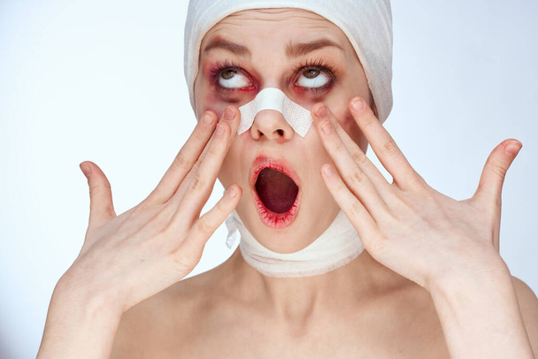 emotional woman facial injury health problems bruises pain close-up - Photo, Image