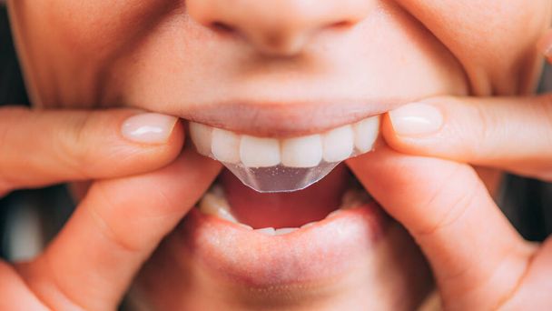 Whitestrips or Teeth Whitening Strips. - Foto, Imagen