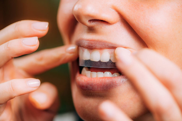 Fehérítő pecsétet vagy fehérítőt használó nő. Fehérítő fogak otthon.  - Fotó, kép