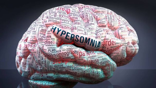 Hypersomnie im menschlichen Gehirn, hunderte von entscheidenden Begriffen im Zusammenhang mit Hypersomnie, die auf einen Kortex projiziert werden, um ein breites Ausmaß der Erkrankung zu zeigen und Konzepte zu erforschen, die damit verknüpft sind, 3D-Illustration - Foto, Bild