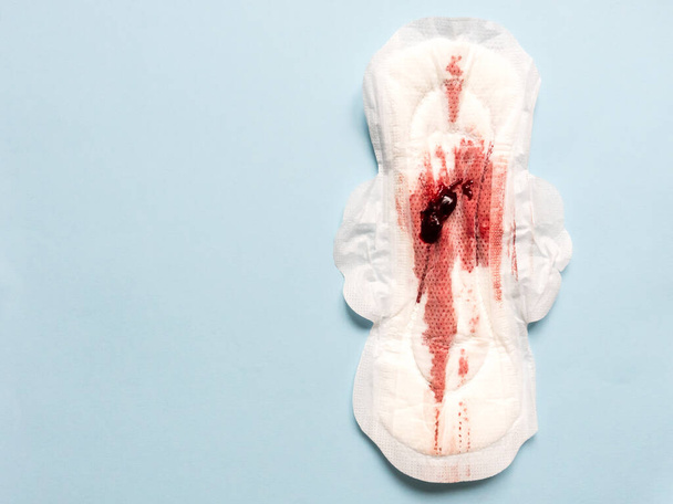 Symptôme d'endométriose, sang menstruel avec caillots sanguins sur une serviette hygiénique. - Photo, image