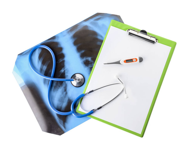Röntgenbild der Lungen mit Klemmbrett, Stethoskop und Thermometer auf weißem Hintergrund - Foto, Bild